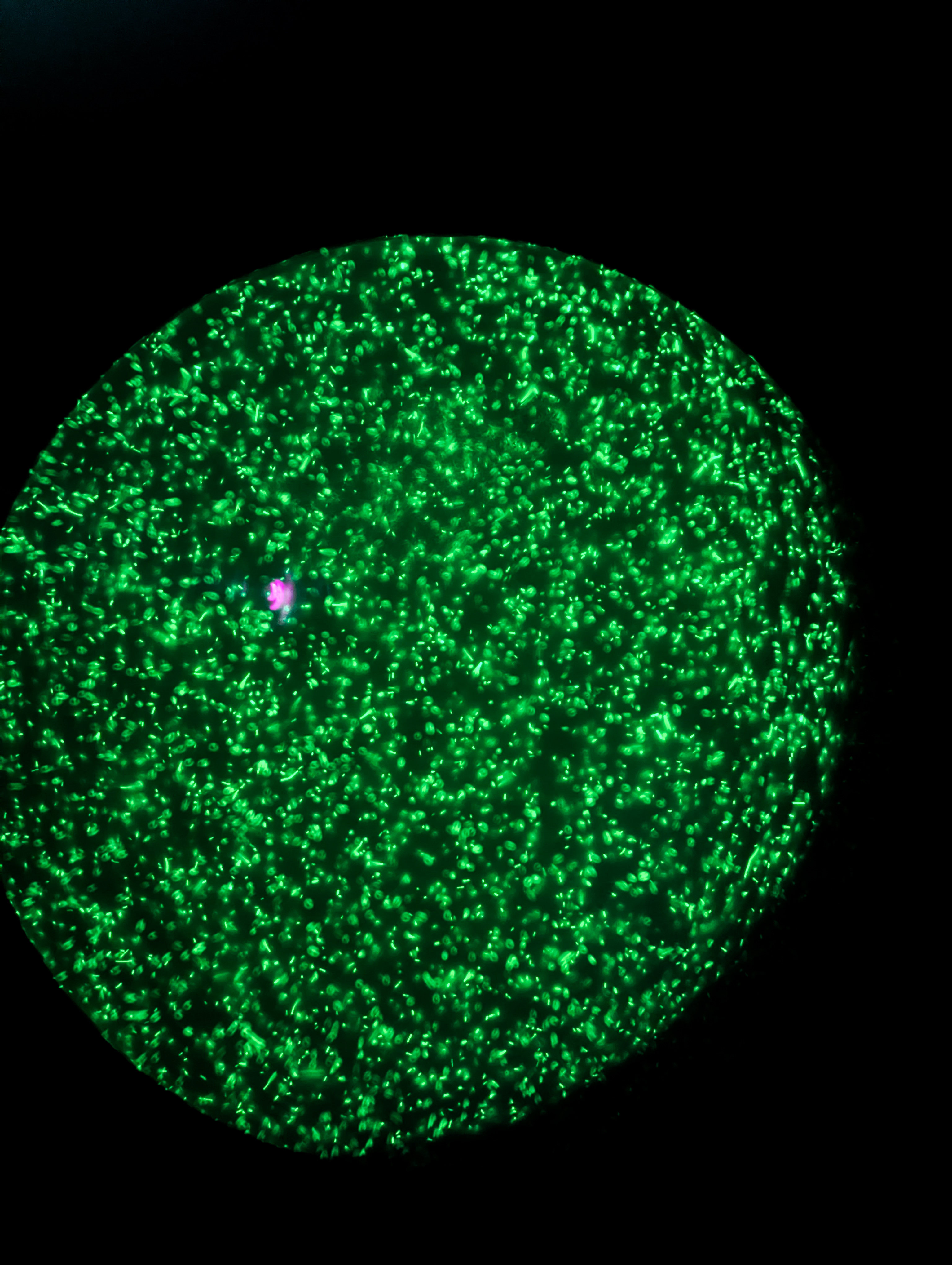Fluorescence microscopy image of thousands of green, glowing Pseudomonas aeruginosa bacterial cells scattered across a dark background, creating the appearance of a field of distant stars