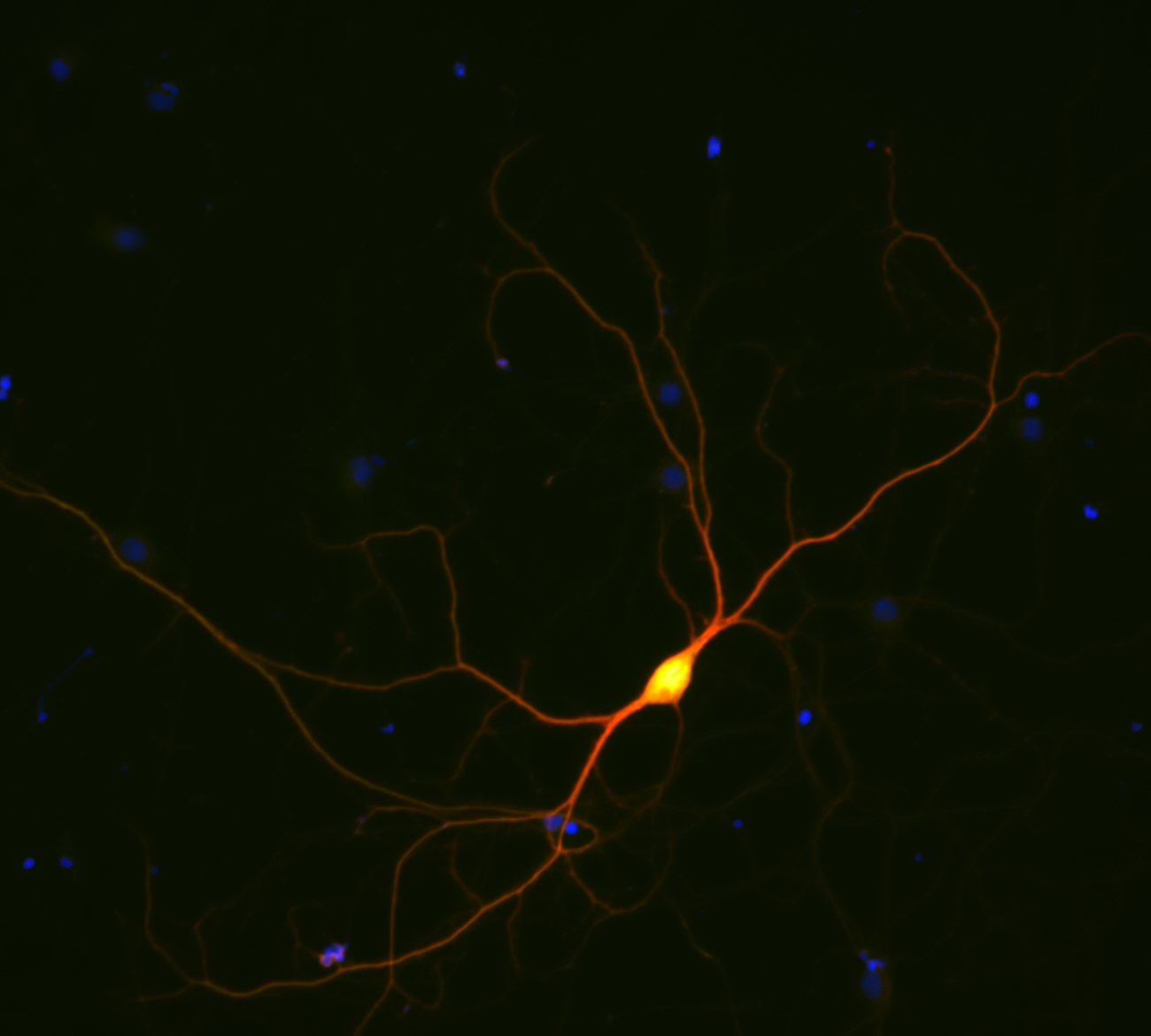 Enzymes in neurons, which look like lightening in a dark sky