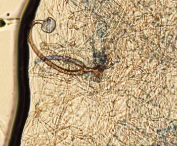 Alt text: Microscopic image of a mycorrhiza, showing fungal hyphae intertwined with plant root cells.